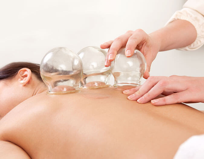 Cups applied to a woman's back as part of a cupping massage